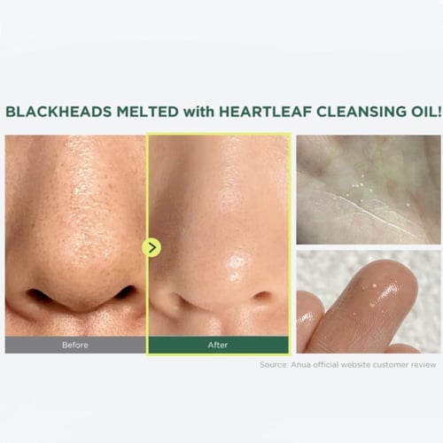 انوا غسول زيتي للتحكم في المسام 200 مل