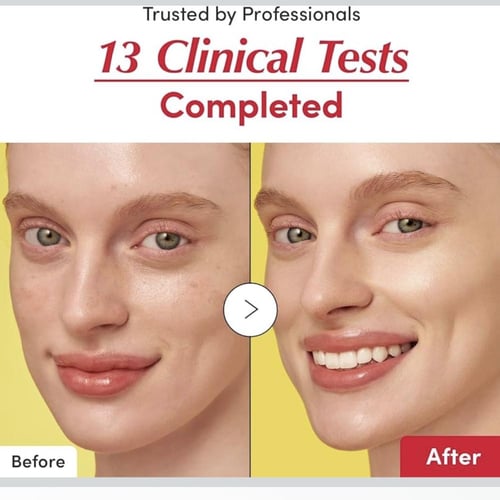 EQQUALBERRY - Vitamin Illuminating Serum إيكوالبير...