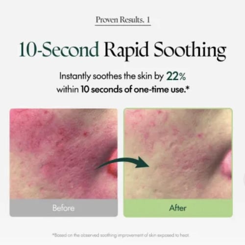 Purito SEOUL - Wonder Releaf Centella Serum Unscen...