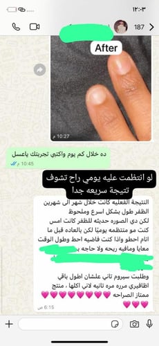زيت لتطويل وتقوية الاظافر