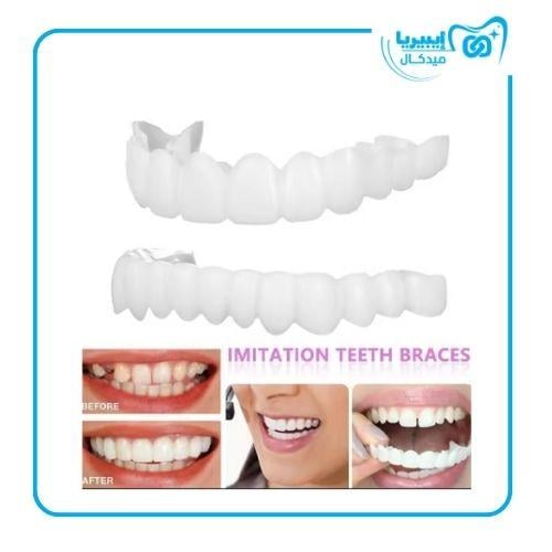 ابتسامة مؤقته/ temp smile