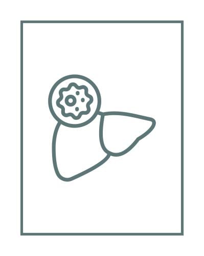 التوصيات الغذائية لمرضى سرطان الكبد
