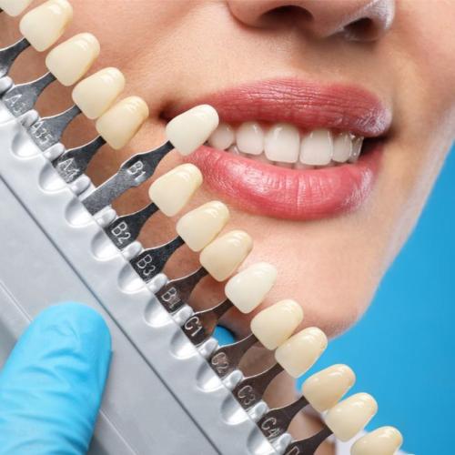 8 تركيبات اسنان هوليوود