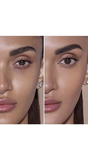 كونسيلر انستازيا