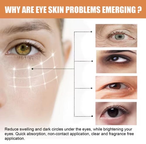 بلسم ومرطب لاسفل العين غني بفيتامين C