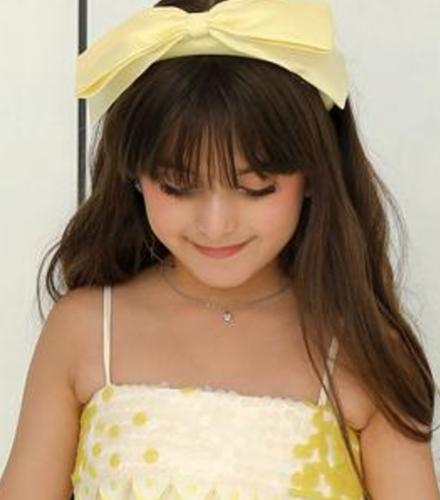A distinctive yellow collar