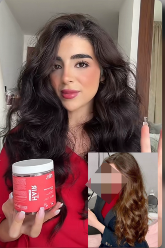 فايتمين فرنسي لزيادة طول وكثافة الشعر