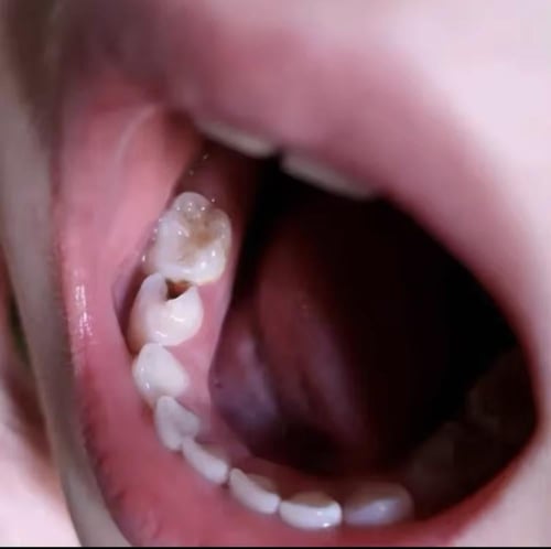 معجون الأسنان السحري