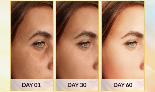 صابونة للتفتيح وازالة البقع الداكنة