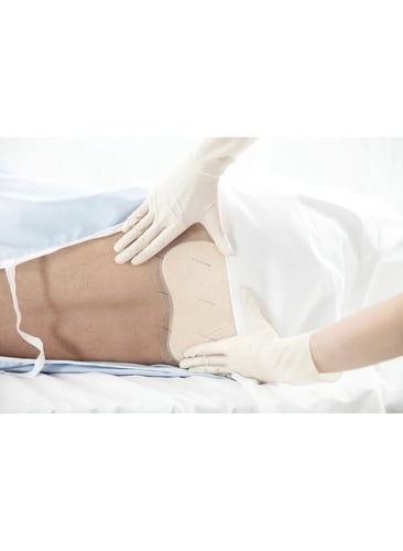 لصقات ميبيلكس للجروح الصعبة وقرح الفراش – مقاسات ك...