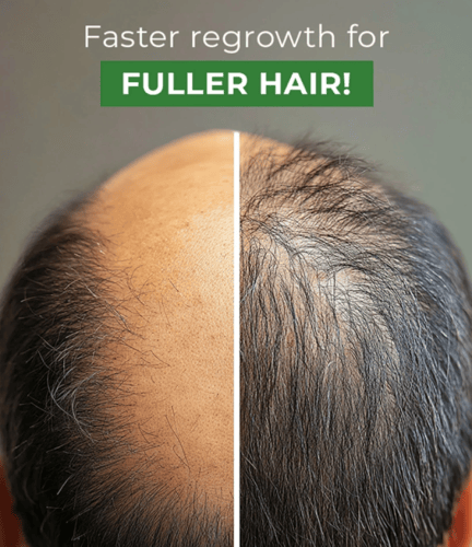 نيو هير لوشن (الأصلي) من جرين ويلث