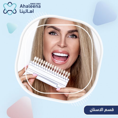 ابتسامة natural طبيعية 6 سن