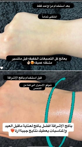 باكج الإشراقة لعناية العيد