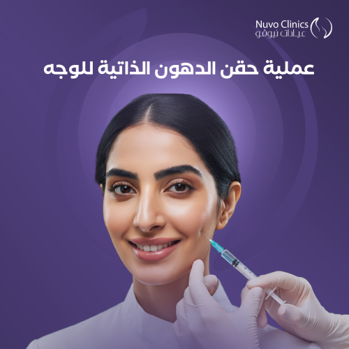 عملية حقن الدهون الذاتية للوجه