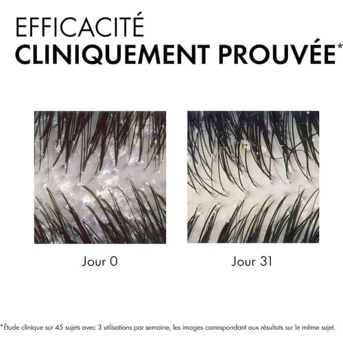 فيشي ديركوس شامبو ضد القشرة للعناية بالشعر الجاف -...