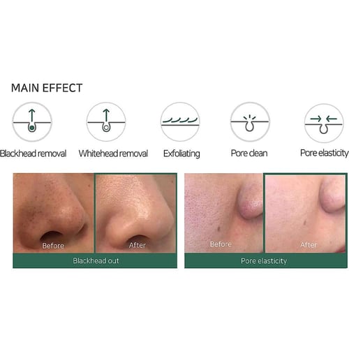 سوم باي مي منظف فقاعات شجرة الشاي المعجزة لتنظيف ا...