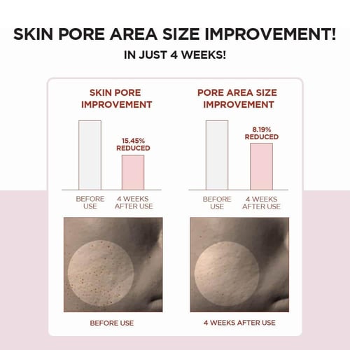 سكين 1004 سنتيلا تونر لتنقية المسام - 210 مل