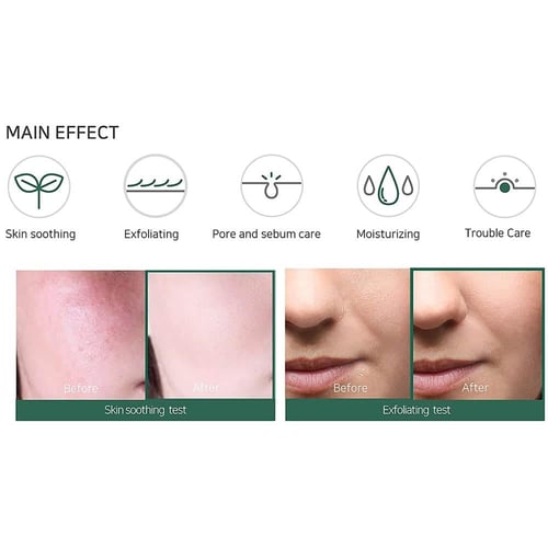 سوم باي مي سيروم أحماض التقشير المعجزة - 50 مل