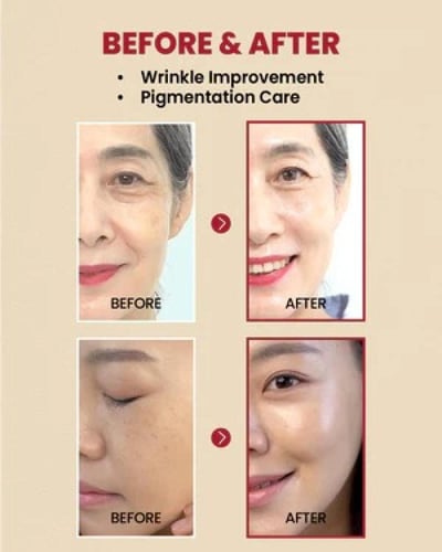 سيروم K‑SECRET - SEOUL 1988: ليبوسوم الشبكية 2% ​​...