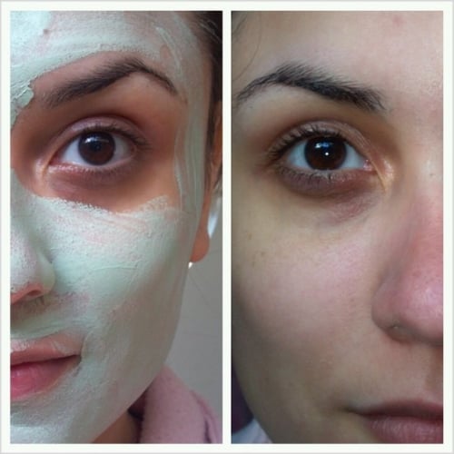 قناع النعناع مع الجلاب لمعالجة حب الشباب من شركة ك...