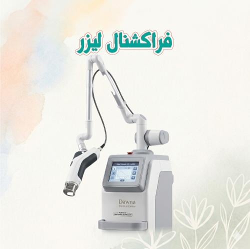 فراكشنال ليزر