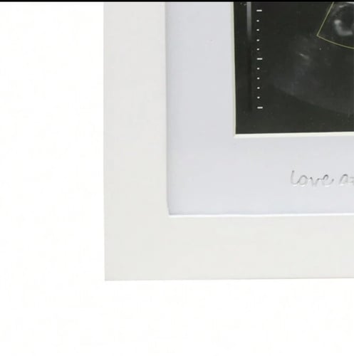 إطار سونار لحفل كشف جنس الجنين