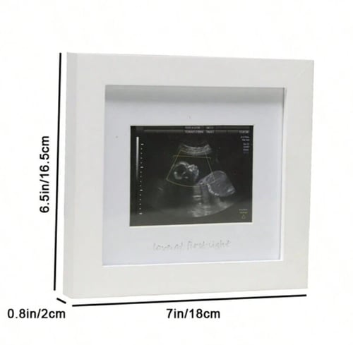 إطار سونار لحفل كشف جنس الجنين