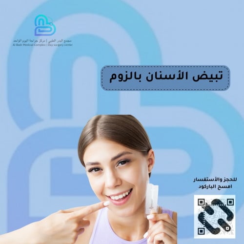 تبيض الأسنان بالزوم