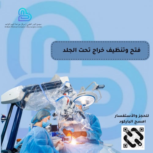 فتح وتنظیف خراج تحت الجلد تحت التخدیر العام