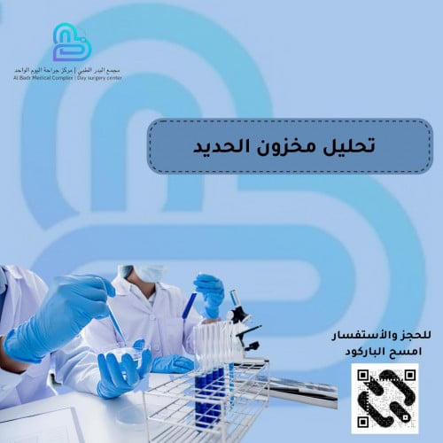 تحليل مخزون حديد