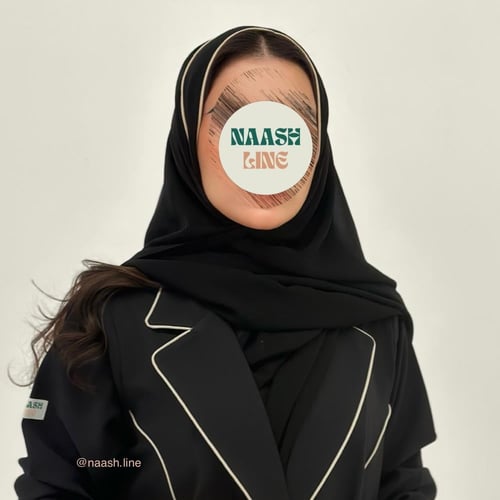 طرحة بطرف (قيطان)