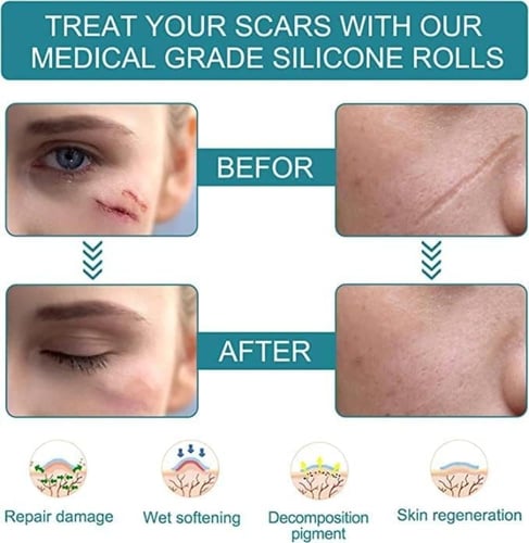 لفة شريط سيليكون لإزالة الندوب بي كير 1.6 إنش×60 إ...
