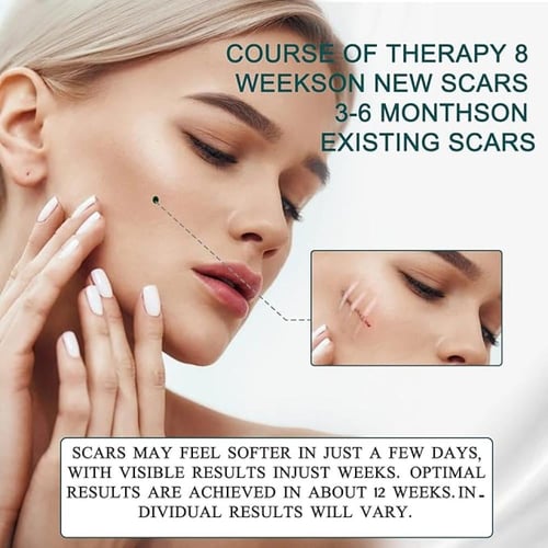 أشرطة الندبات من السيليكون بي كير 120×1.6 إنش - 3م...