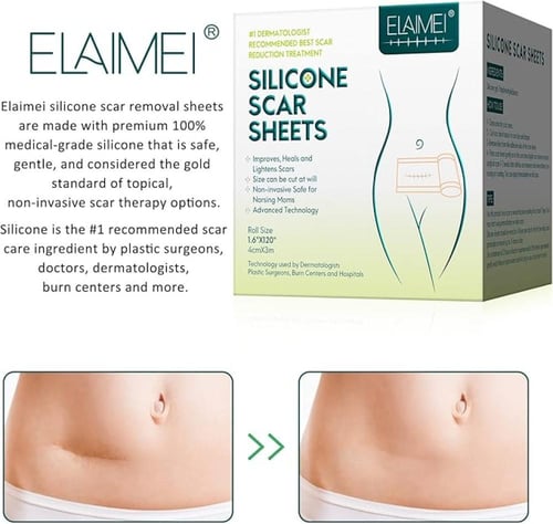 أشرطة الندبات من السيليكون بي كير 120×1.6 إنش - 3م...