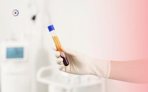 علاج الالتهابات المتكررة ( تشمل عينة من المهبل+تحل...