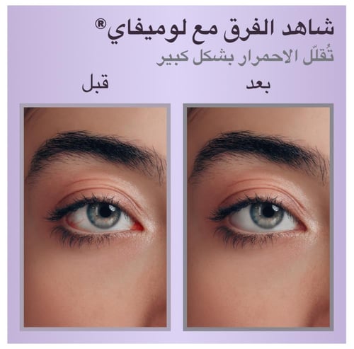 لوميفاي طرطرات البريمونيدين محلول قطرة العين %0.02...