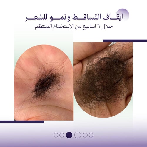 مجموعة العناية المتكاملة للشعر والرموش