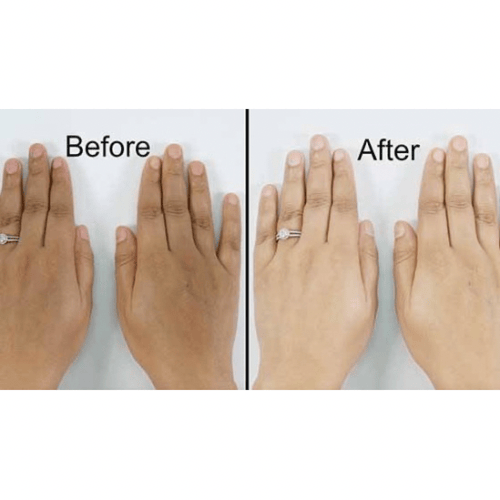 مجموعة التفتيح بالجلوتاثيون