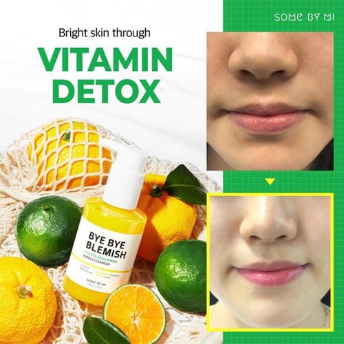 منظف فقاعات فيتا توكس لتنظيف وتفتيح البشرة من سوم...