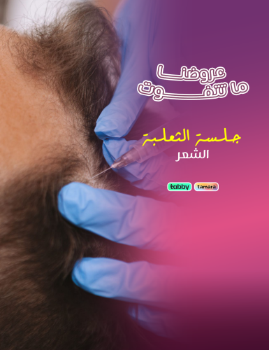 A treatment session for alopecia