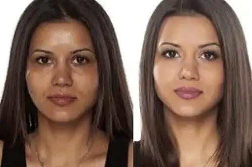 Glutathione injection + Transmuc