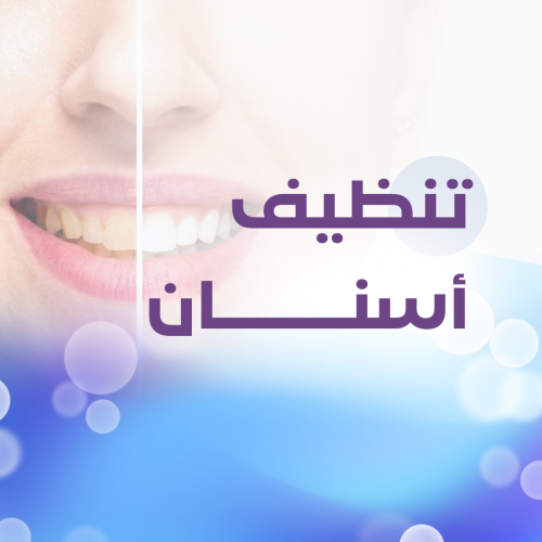 Tooth cleaning and polishing