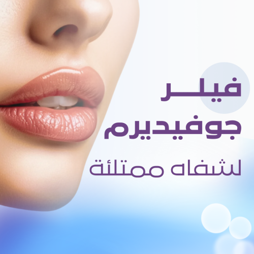 1 ml filler Juvederm
