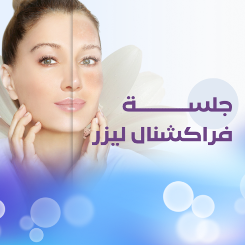 Fractional laser session