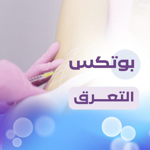 Botox for sweating