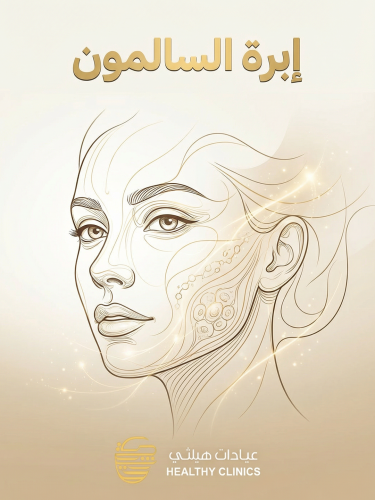 ابرة السالمون