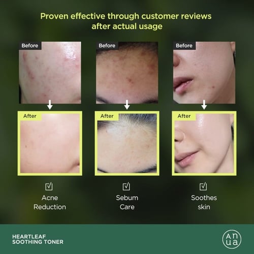 أنوا هارت ليف تونر 77% مهدئ للبشرة الحساسة 250 مل