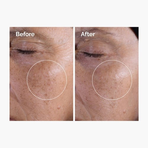 تونر مقشر جليكوليك اسيد 7٪ من ذا اورديناري - 240 م...