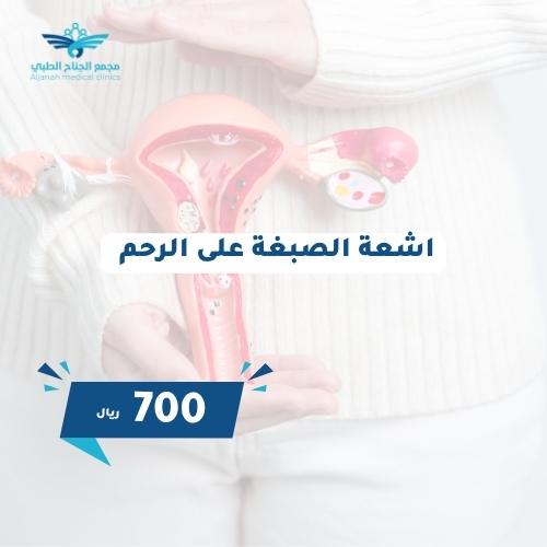اشعة الصبغة على الرحم