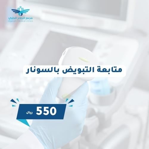 متابعه التبويض بالسونار